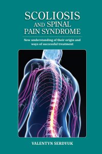 Scoliosis and spinal pain syndrome